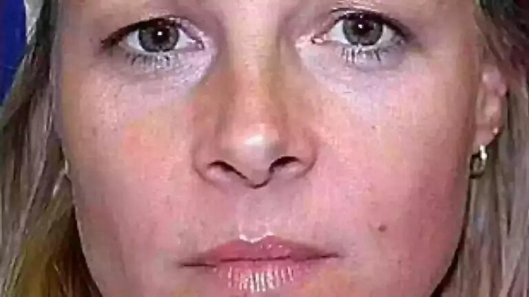 Estudo Revela Efeitos do Botox No Envelhecimento de Gêmeas