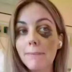 Mulher de 33 anos passa por emergência médica durante voo no exterior