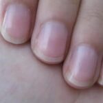 O que o crescimento das unhas revela sobre sua saúde e envelhecimento