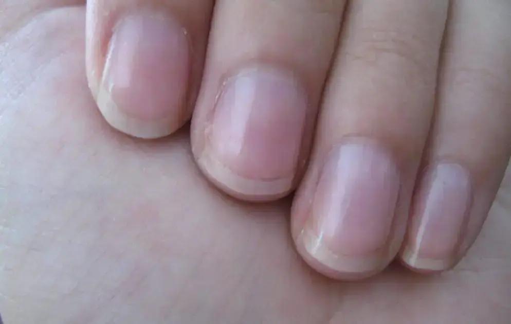 O que o crescimento das unhas revela sobre sua saúde e envelhecimento