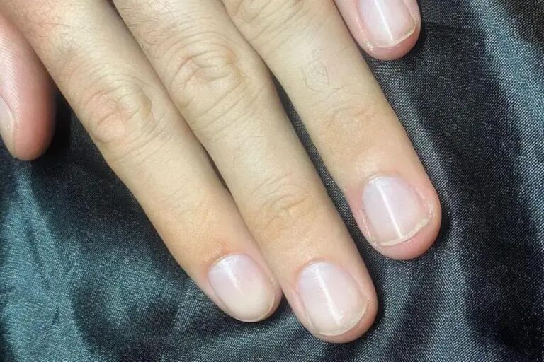 Você sabia que o crescimento das unhas pode indicar sua expectativa de vida?
