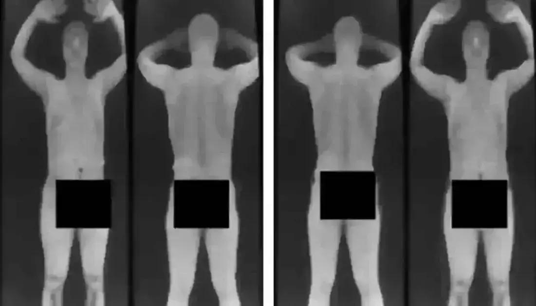 Como os Scanners de Aeroporto Mudaram a Segurança e a Privacidade
